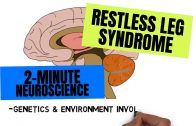 2-Minute-Neuroscience-Restless-Legs-Syndrome