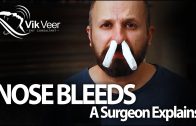 10-ways-to-Stop-a-Nose-Bleed-A-Surgeon-Explains